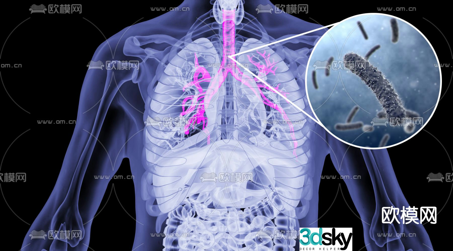 Human bronchitis 3d model