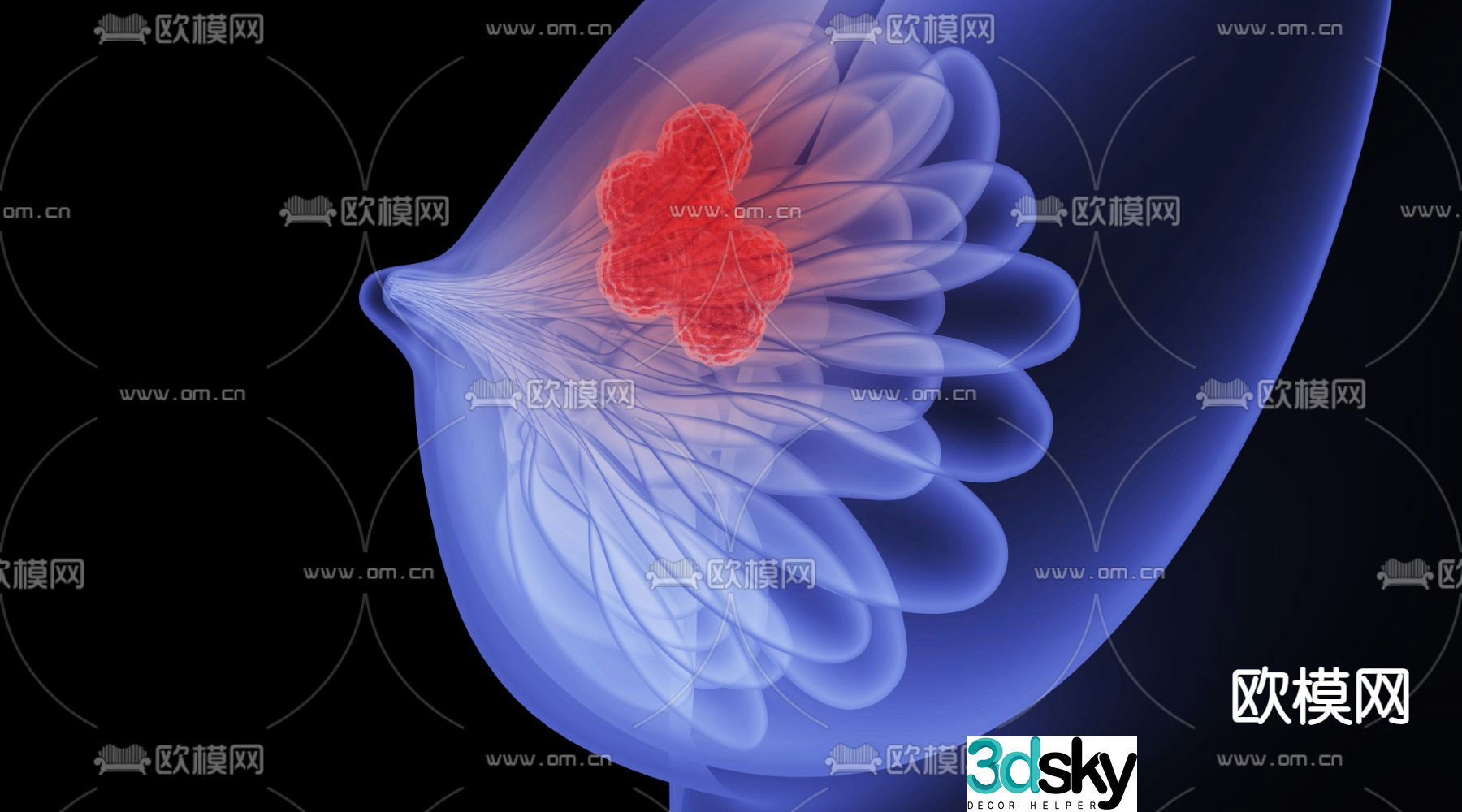 Breast nodule 3D model